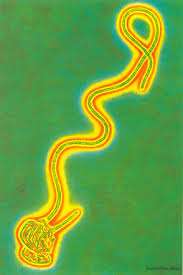 اشتباه في مواطن سعودي بإصابته بفيروس "الإيبولا"